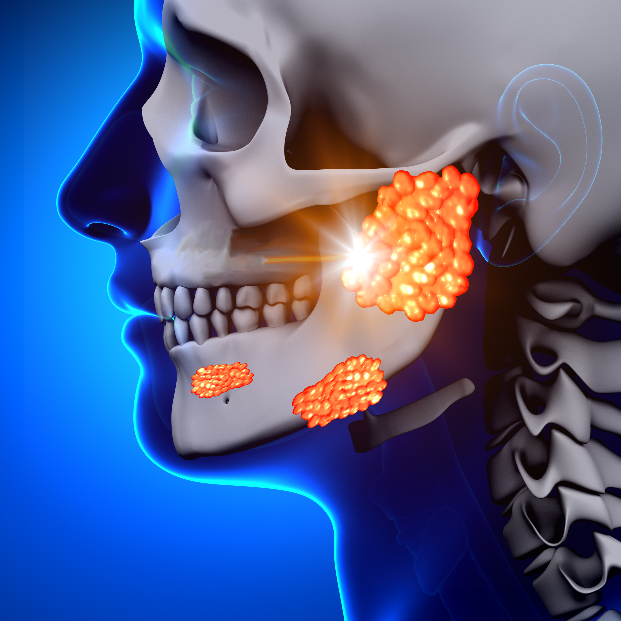 Salivary Gland Tumors doctorlansford.com